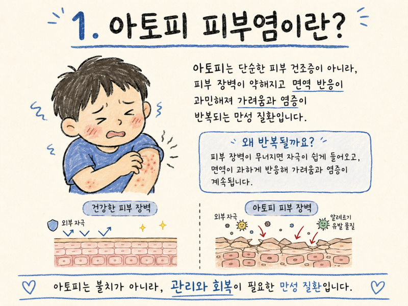 반복되는 아토피 피부염과 태열, 근본적인 피부 회복을 위한 한방 치료