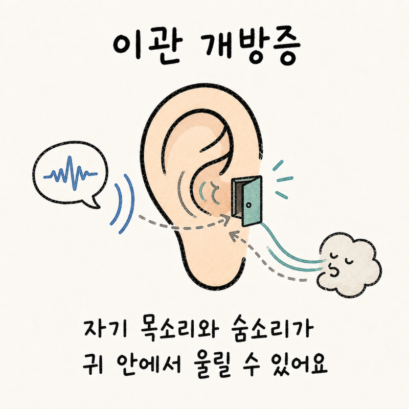 인천 송도 이관 개방증 · 자성강청 · 자기 목소리 울림