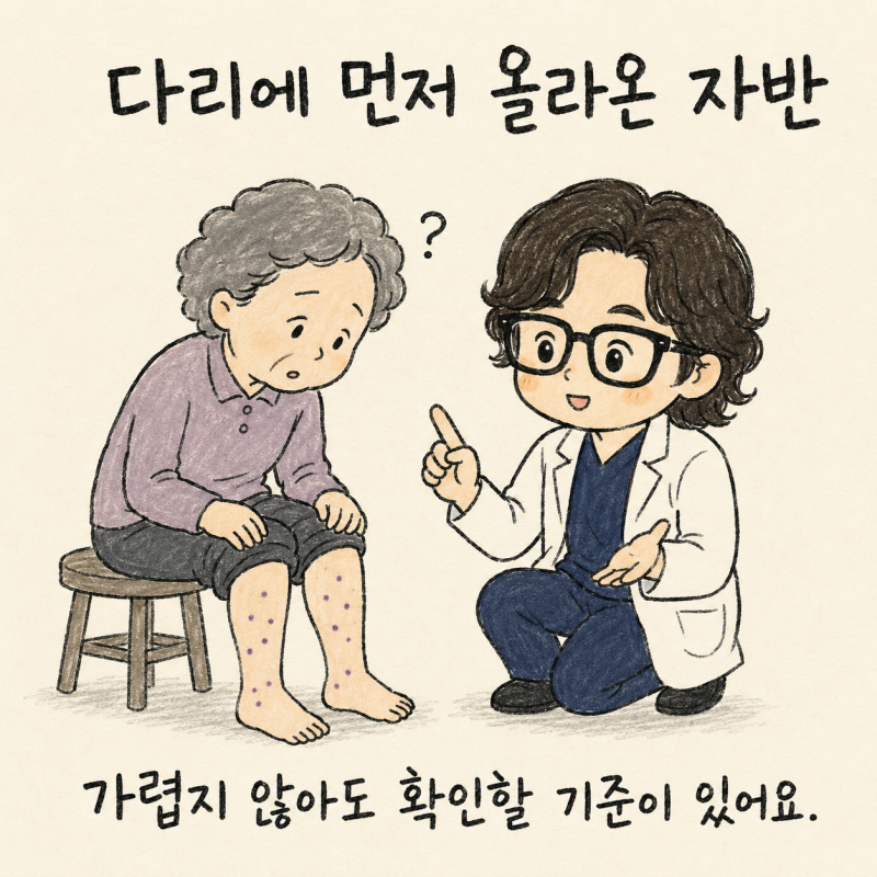 피부 자반증, 다리에 먼저 올라오고 팔까지 번질 때 | 인천 송도 혈관염