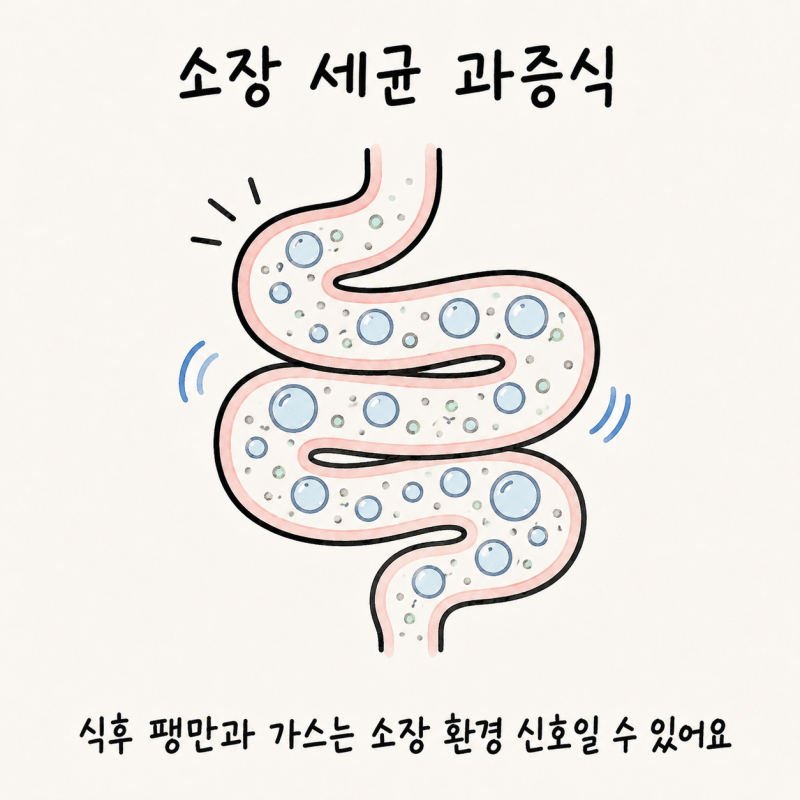 인천 송도 소장 세균 과증식 · 소장내 균 교대증 · 장내 세균 불균형 · SIBO