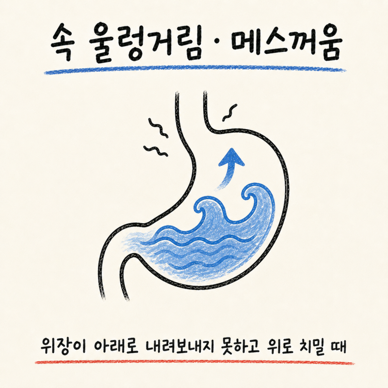 인천 송도 속 울렁거림·메스꺼움· 오심