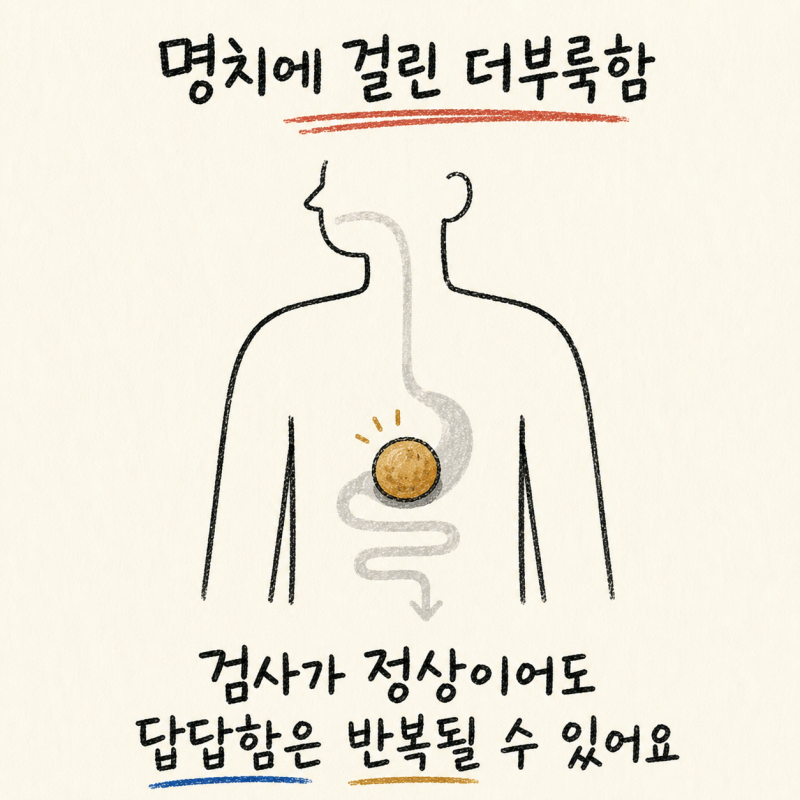 인천 송도 명치 답답 · 명치 더부룩