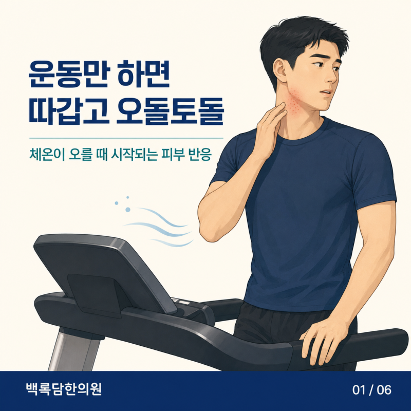 운동만 하면 따갑고 오돌토돌해지는 피부, 20대 남성 콜린성 두드러기 | 인천 송도 한의원