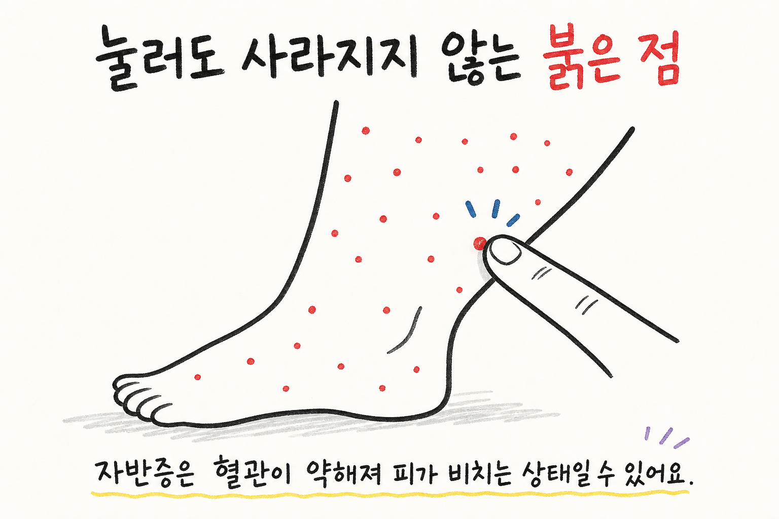 시흥 배곧신도시 자반증 · 다리 붉은 반점