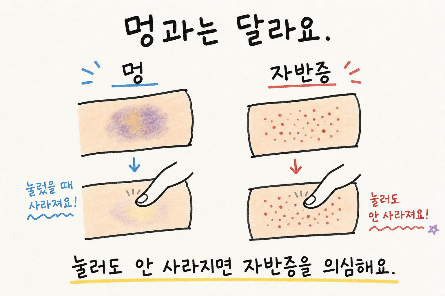 눌러도 남으면 자반증, 사라지면 발진