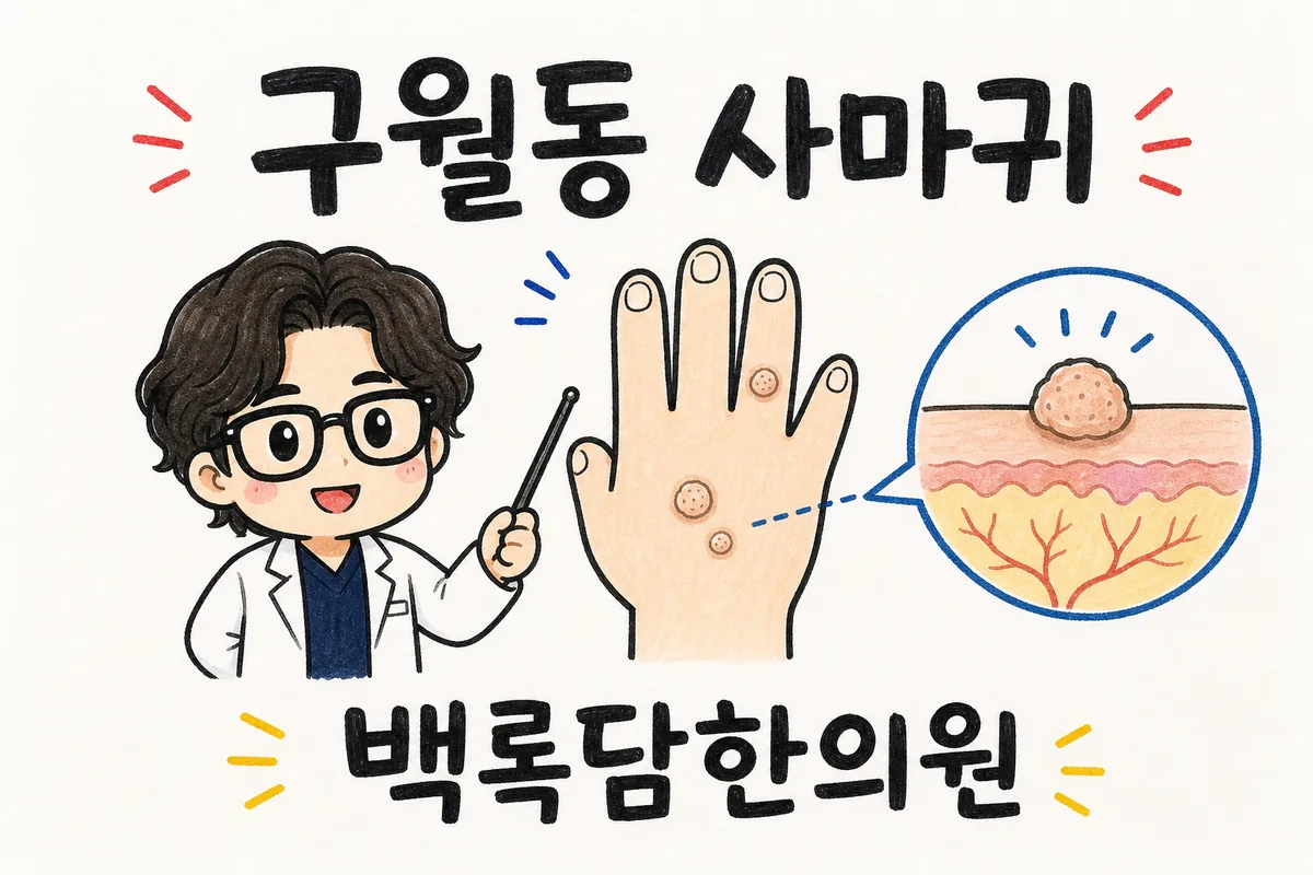 구월동 발바닥 사마귀, 깎아도 깎아도 또 돋아날 때