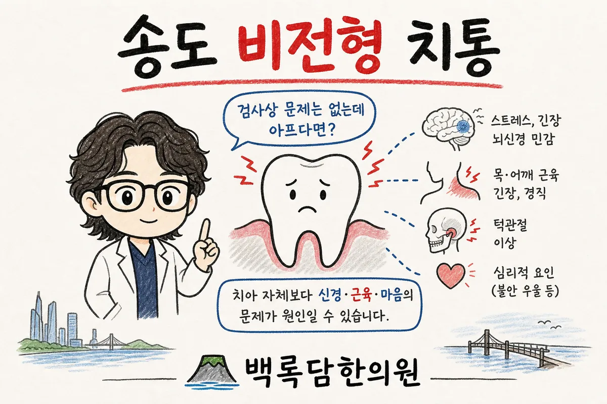 송도 비전형 치통, 엑스레이엔 안 나오는데 계속 치아가 아플 때