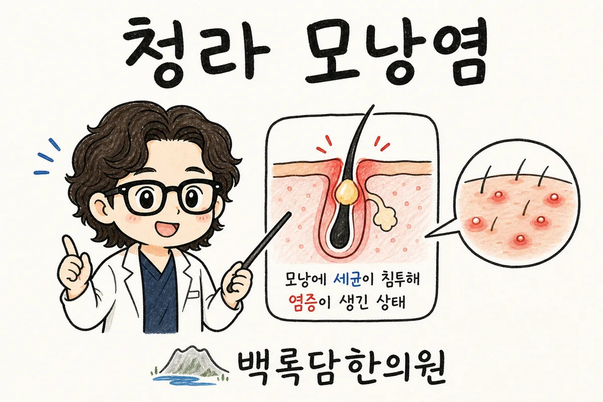 청라 모낭염, 치료해도 자꾸 도져서 스트레스받는 20대 남성분께