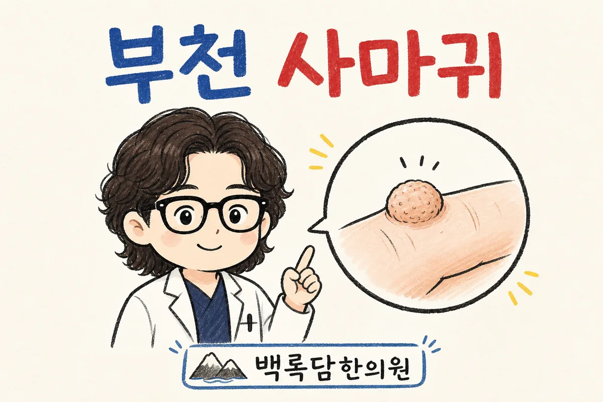 부천 손 사마귀, 검사는 정상이라는데 자꾸 번지고 안 없어질 때