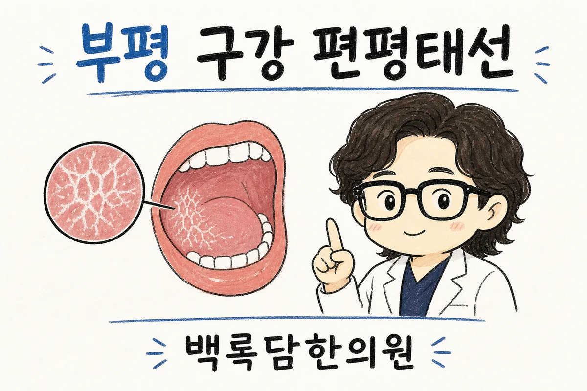 부평 구강 편평태선, 입안 하얀 줄이 따가워 밥이 안 넘어갈 때