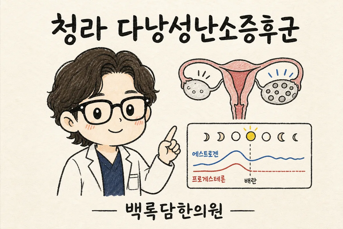 청라 다낭성난소증후군, 검사는 정상인데 몸이 말을 안 듣는 50대