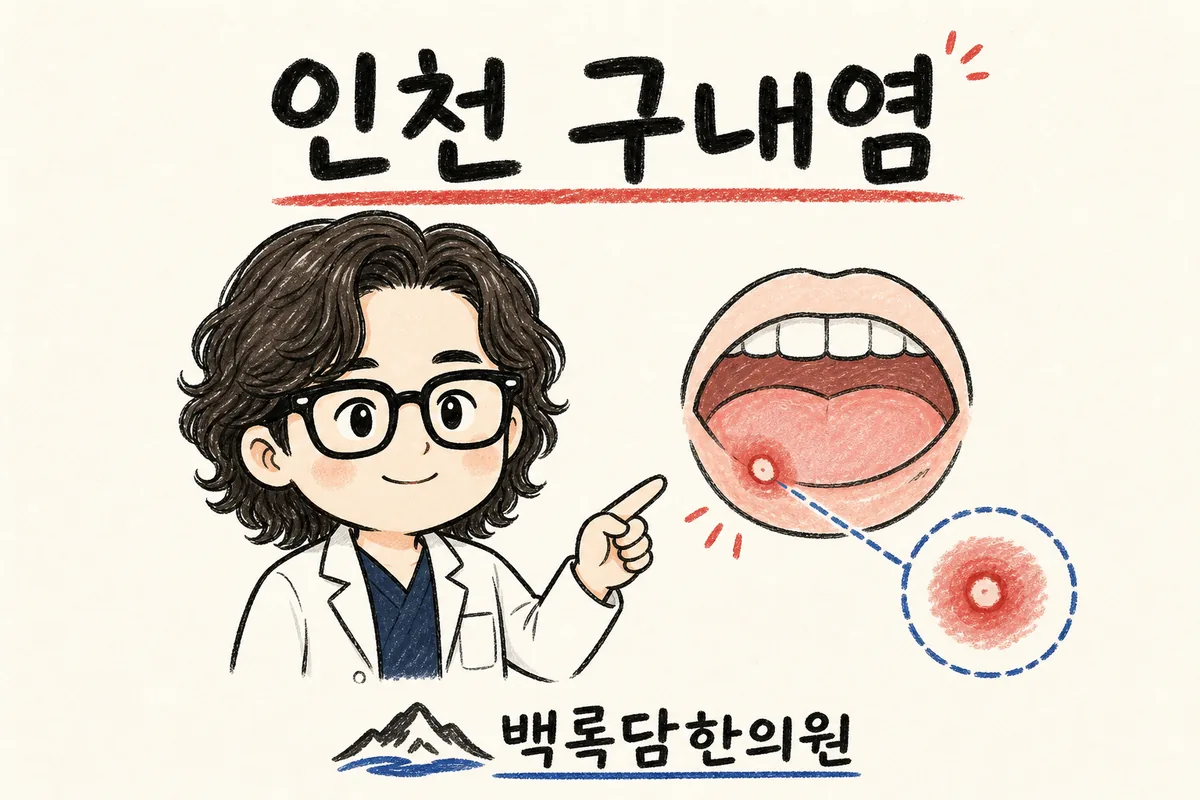 인천 구내염, 밤마다 입안이 따가워 잠을 못 드는 밤이 반복될 때