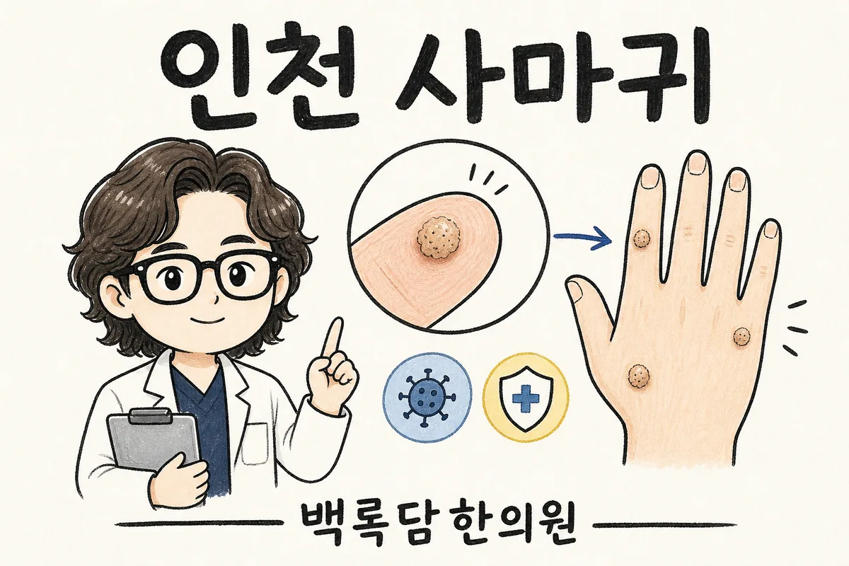 인천 연수구 발바닥 사마귀, 깎아내도 자꾸 같은 자리에 돌아올 때