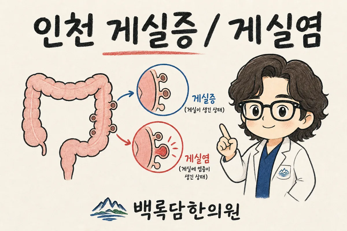 인천 남동구 게실증, 밤마다 아랫배가 결려 항생제를 써도 자꾸 재발할 때