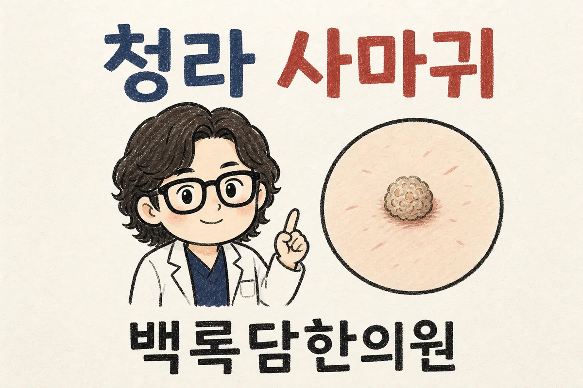 청라 손 사마귀, 깎아내도 자꾸 번지고 밤에 더 신경 쓰일 때