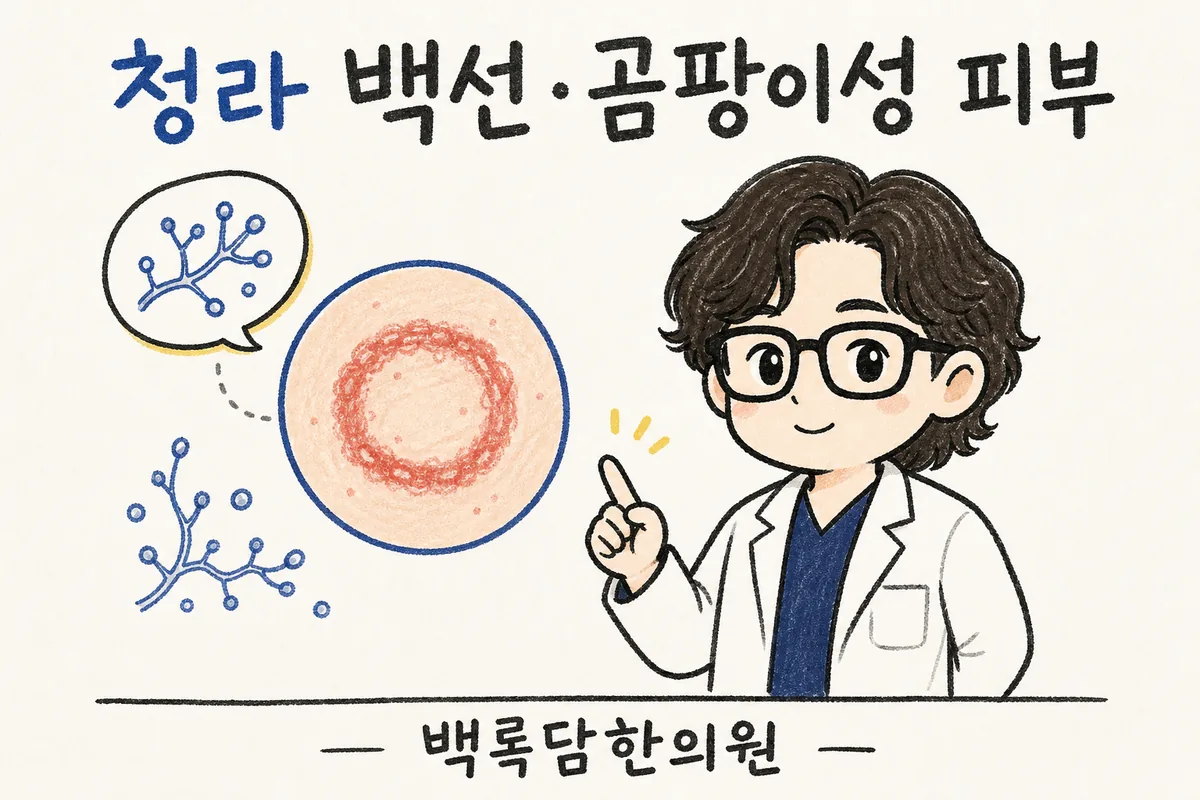 청라 백선·곰팡이성 피부, 약 발라도 자꾸 도지는 붉은 반점