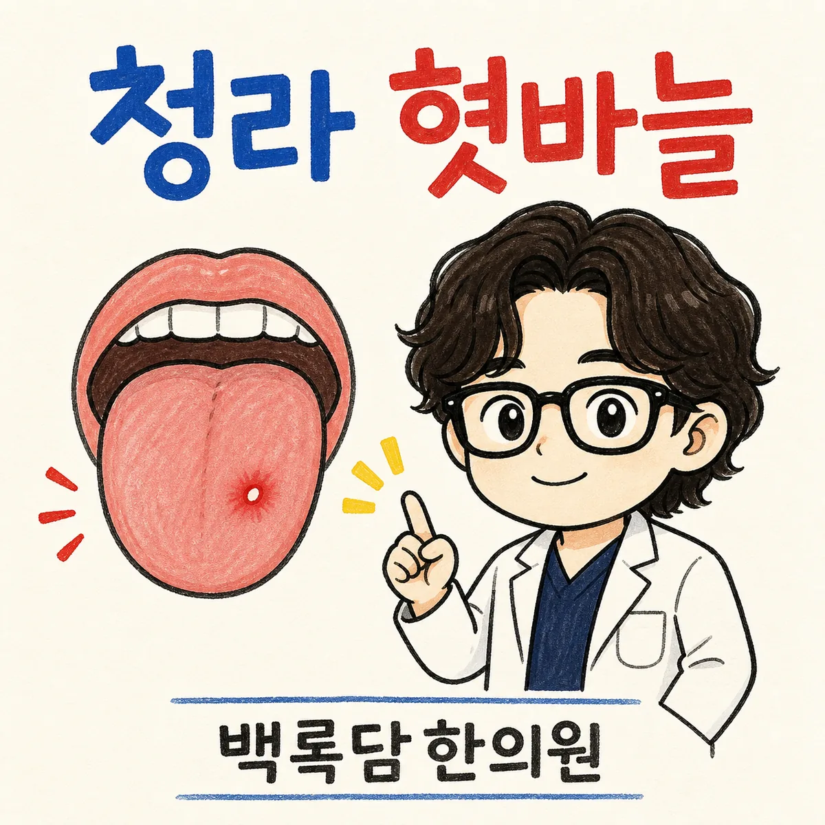 청라 혓바늘, 교대근무 탓에 혀가 자꾸 헐고 지도처럼 변할 때