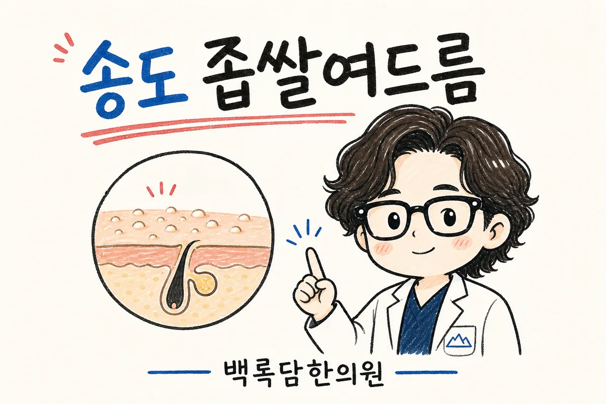 송도 좁쌀여드름, 잠 못 자고 야근하는 남자 이마에 자꾸 좁쌀이 번질 때