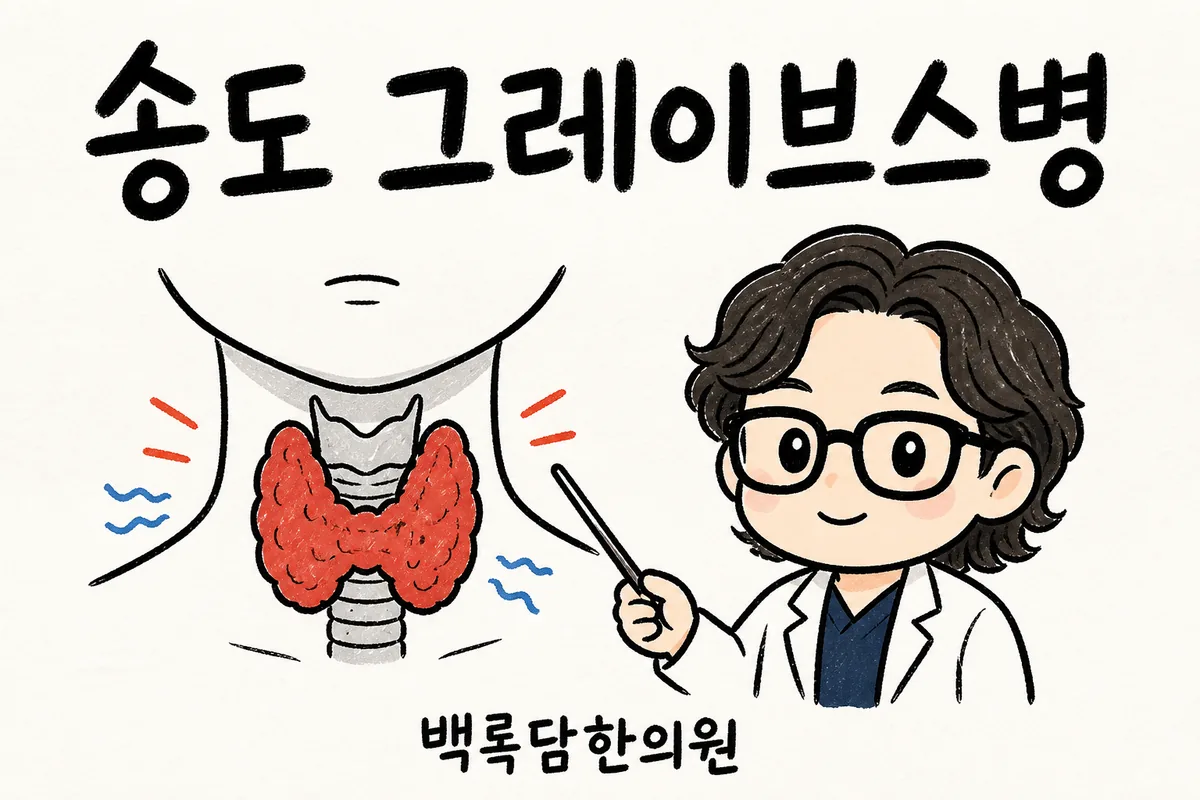 송도 그레이브스병, 하루 종일 서서 일하는데 심장 두근거리고 살이 빠질 때