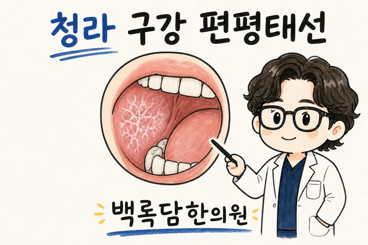 청라 구강 편평태선, 검사는 정상인데 입안 따가움이 계속될 때