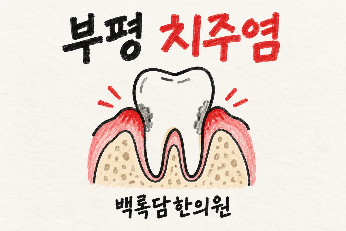 부평 치주염, 스케일링 받아도 잇몸에서 피가 멈추지 않을 때