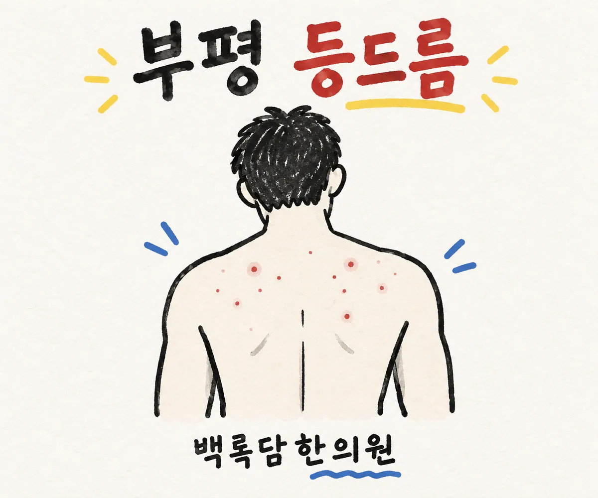 부평 등드름, 야근 잦은 날들에 등에 번지는 붉은 것들이 멈추지 않을 때
