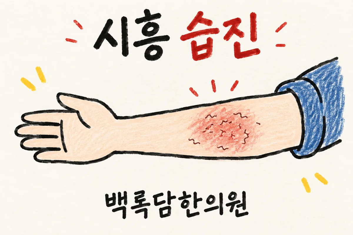 시흥 습진 한방 치료, 약을 발라도 자꾸 도지는 만성 피부 염증일 때