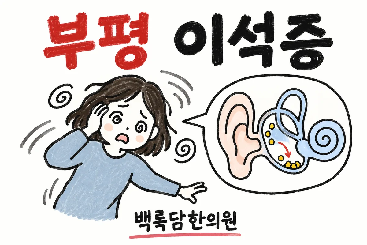 부평 이석증, 치료받아도 자꾸 도지는 빙글빙글 어지럼증