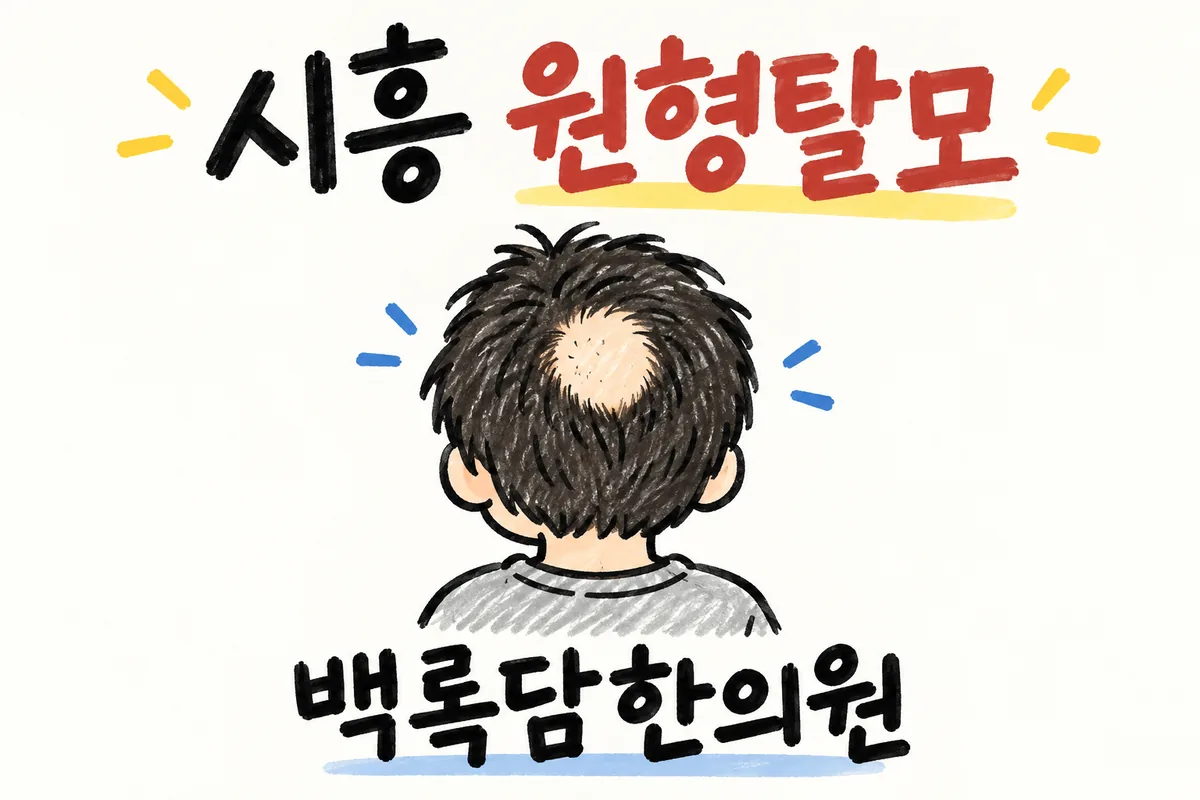 시흥 원형탈모, 아침 거울에서 발견한 머리 구멍이 또 생길 때