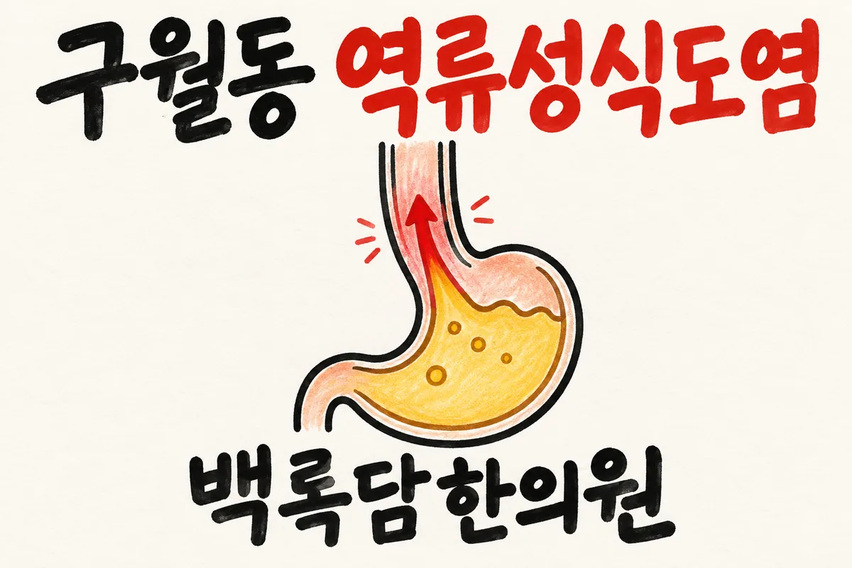 구월동 역류성식도염, 밤에 누우면 가슴이 타고 신물이 올라올 때