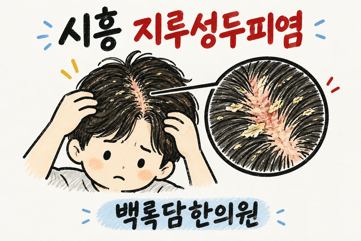 시흥 지루성두피염, 스트레스 터진 뒤 머리에 비듬과 뾰루지가 반복될 때