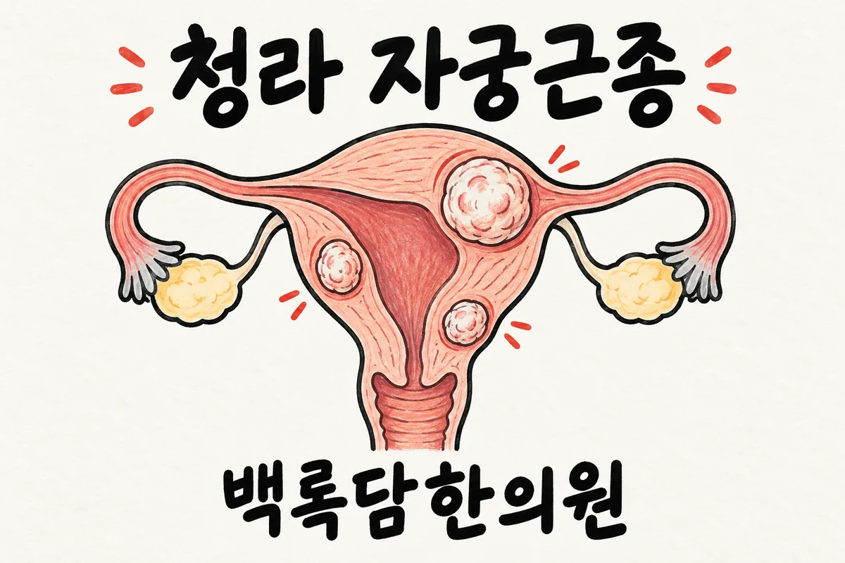 청라 자궁근종, 검사는 괜찮다는데 하복부가 무겁고 생리가 버거울 때