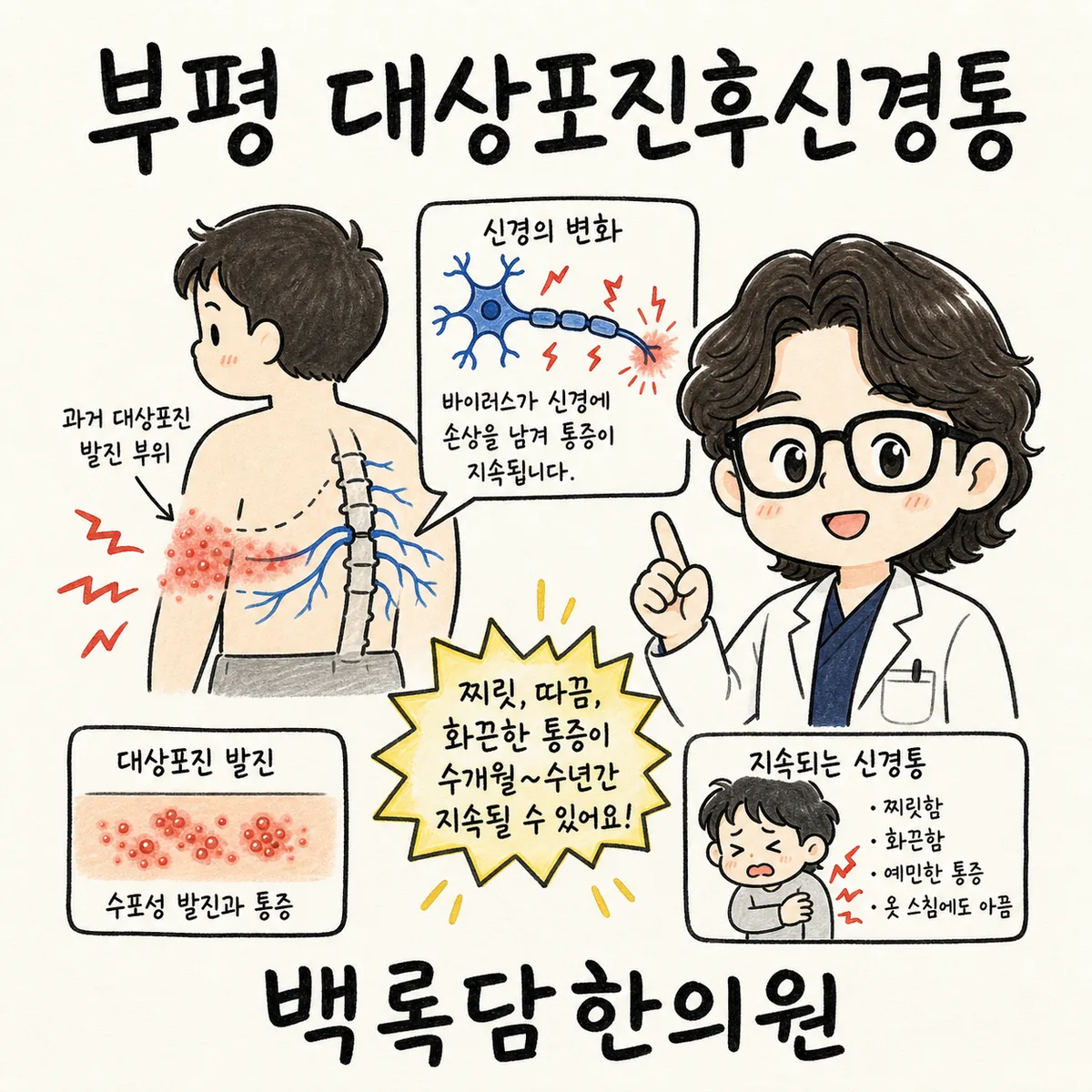 부평 대상포진후신경통, 발진은 나았는데 옷만 스쳐도 불에 덴 것 같을 때